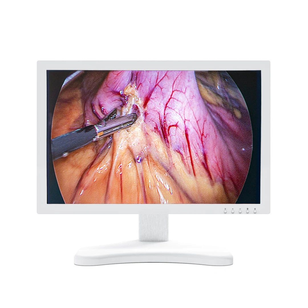 CHANGFAN Full HD video endoscope camera system 1080P for laparoscopy ENT Urology Arthroscope gynecology