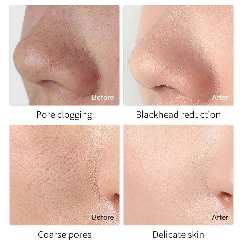 Private Label Skin Care Set Korean Cosmetics Face Care Brightening Anti Acne Face & Body Mask Mud Rose Face Pink Clay Mud Mask