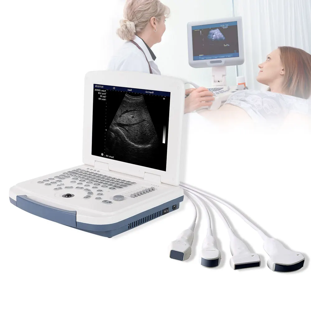 LTUB45 Portable Laptop 12 Inch Women Pregnancy Scanner Ultrasound Instruments B/W Digital Ultrasound Scanner