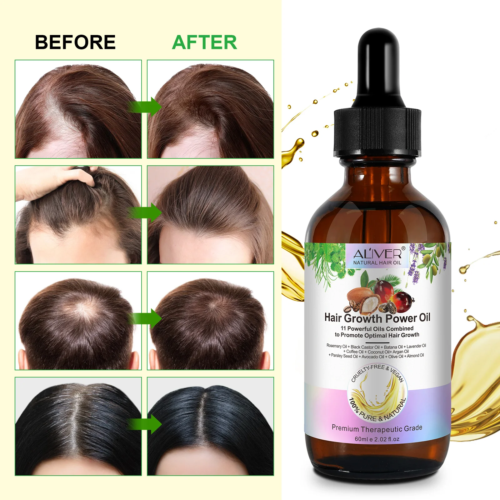 ALIVER 100% Pure Natural Hair Care 11 Powerful Oils Fast Thrive Hair Growth Power Mix Oil Hair Loss Treatment For Women And Men