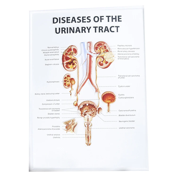 Customized 3D plastic Blister wall chart medical education wall chart 3D pvc poster