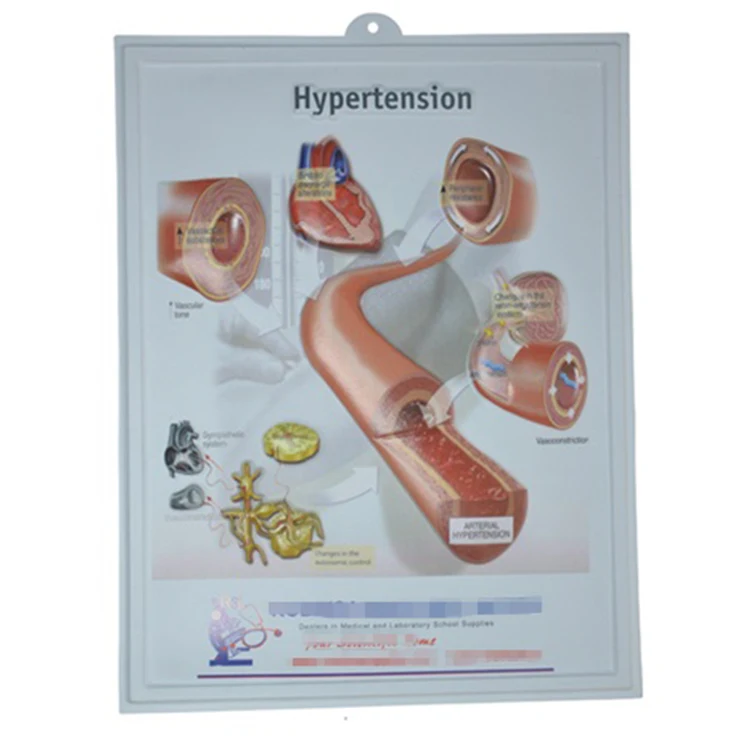 The Educational Plastic 3D Medical Urinary Tract Anatomical Wall Charts/Poster