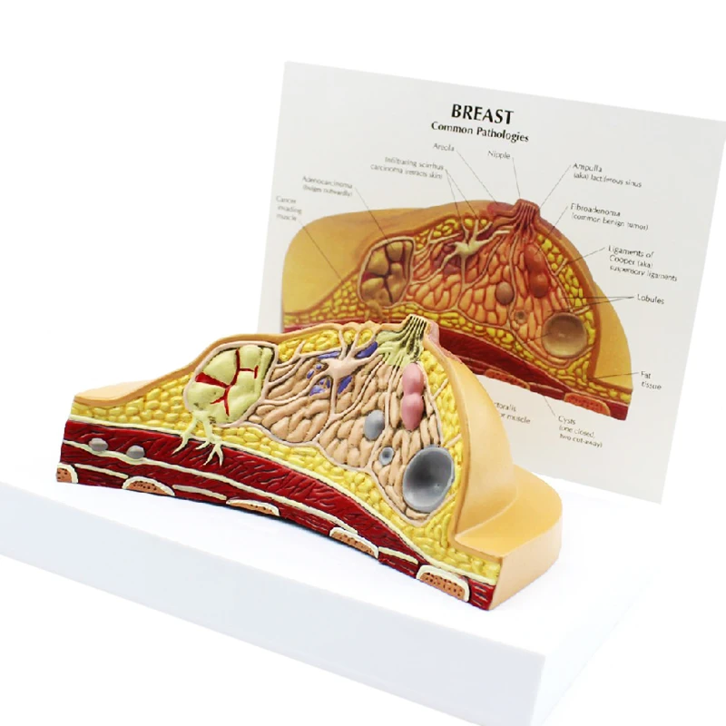 Medical Anatomy System Human Pathology Breast Model For Female Breast Healthy