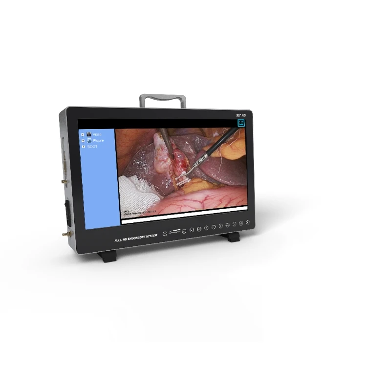 2.3 CMOS Portable all-in-one Medical Endoscopy Camera System with In-Built Recorder AKX YKD-9122H