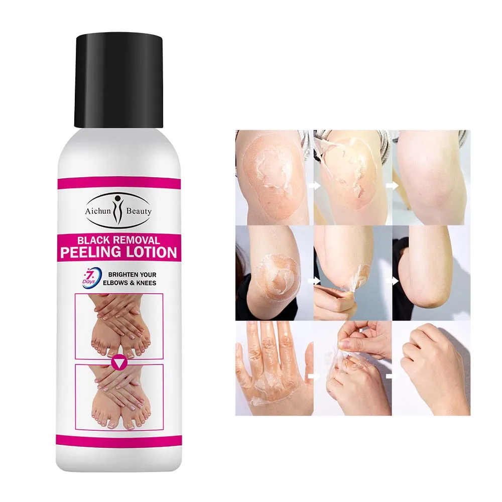 Aichun Beauty 7days Brighten Elbows Knees Black Removal Whitening Peeling Lotion
