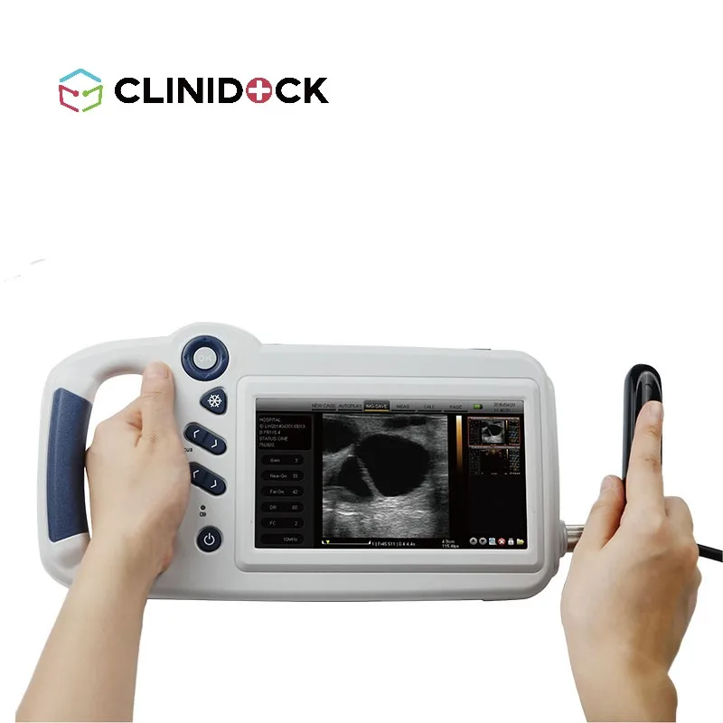 Digital Veterinary Ultrasound Diagnostic System