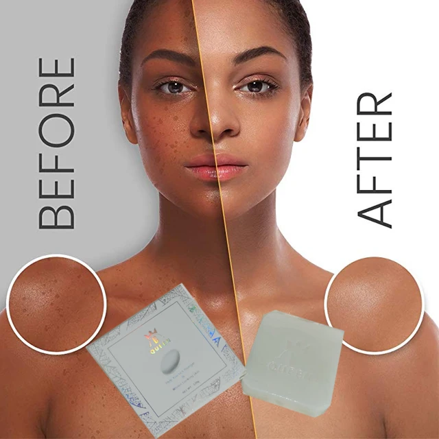 
complexion with the help of this natural bleaching soap whitening give your skin a healthy glow whitening soap korean 