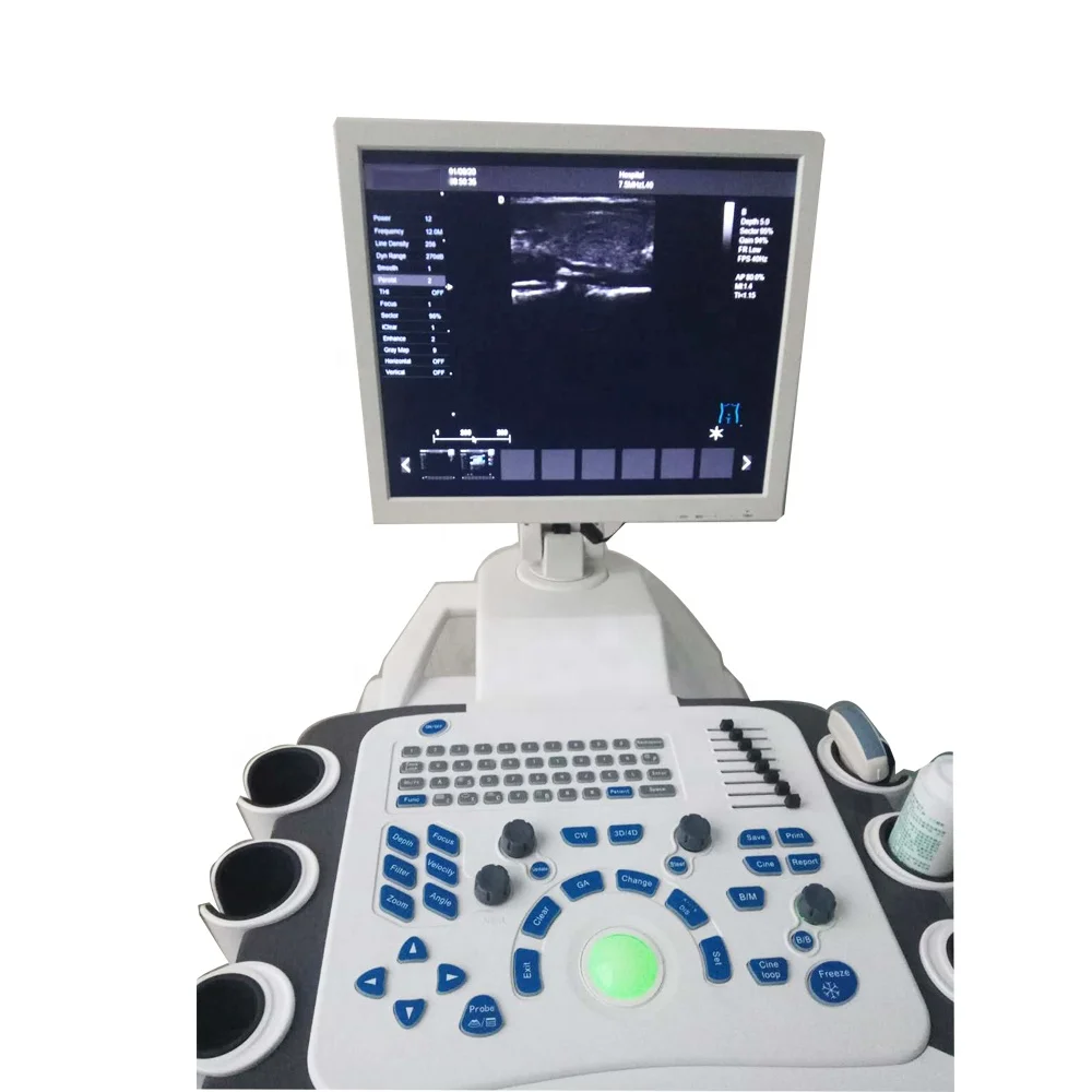Ultrasound Diagnostic doppler fetal monitor