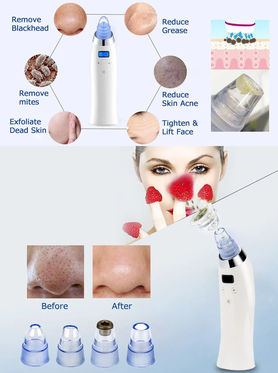Beauty Apparatus Blackhead Suction Beauty Device