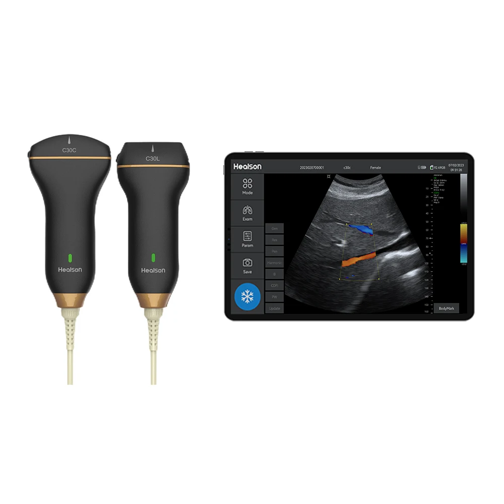 Medic Highest Cost-effective Portable Handheld Ultrasound Convex and Linear Probe With Color Doppler PW PICC Puncture Mode