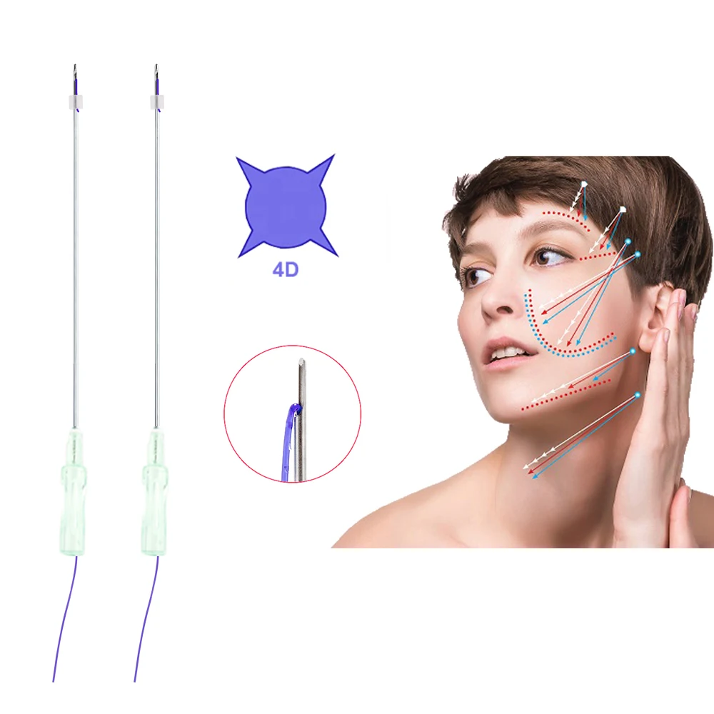 L Half Blunt 21g 60mm Absorbable Collagen 4D Pdo Cog Thread,Double Chin Sagging Skin Lift Bidirectional Barbed 4D Pdo Cog Thread