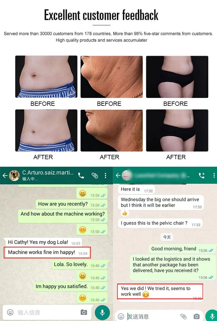 20% OFF cellulite reduction burn fat cryo 360 lipolysis cool tech body sculpting machines fat freezing price