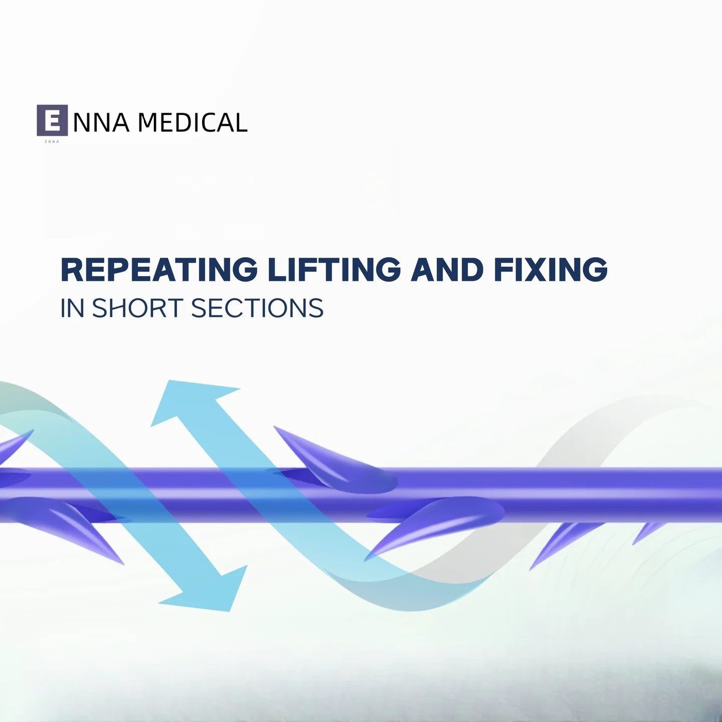 ENNA double cog pdo thread lift korea pdo lifting threads miracu face lifting pdo barbed thread  21G 100mm