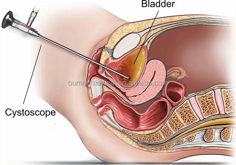 Эндоскопическая камера Cystoscope HD Жесткий хирургический 4 мм 0 30 70 градусов cystoscopy эндоскоп