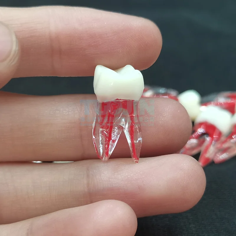 Dental Endo Tooth Root Models Rotary Files RCT Endodontics Practice Block Pulp Cavity Dentistry Training Resin Model