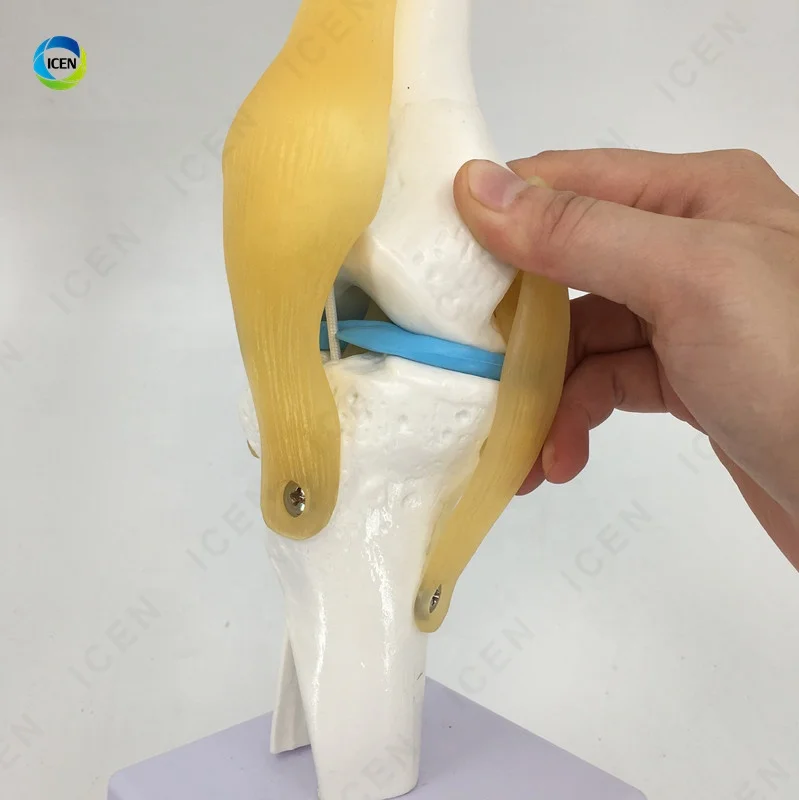 IN-M15 Plastic Elbow Joint With Ligaments,Model Of Human Knee Joint,Elbow Joint Skeleton Model