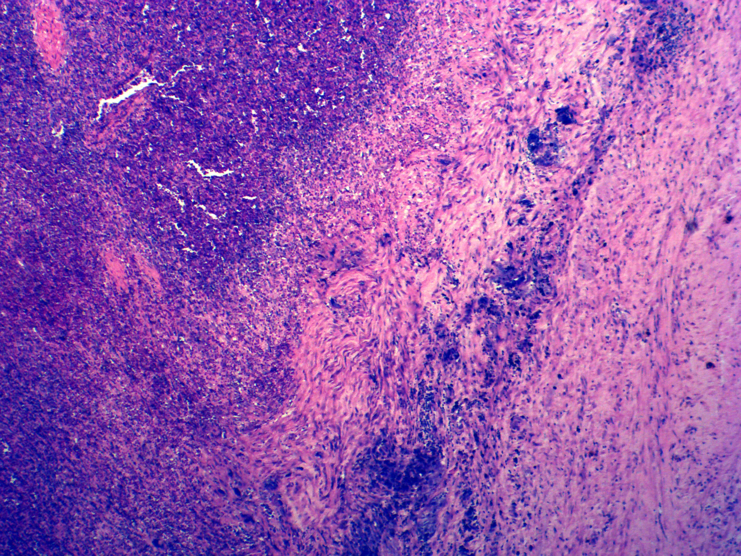 Medical biology laboratory human pathology preparation microscope slide specimen equipment