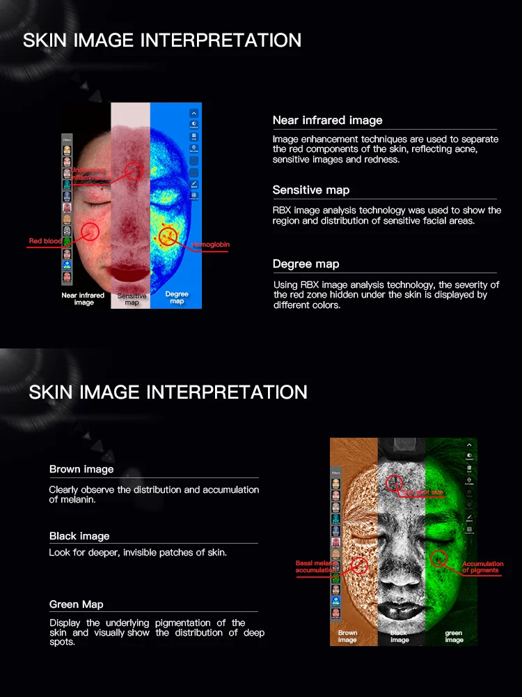 2024 New  Technology Five-Color Spectrum Skin Analyzer