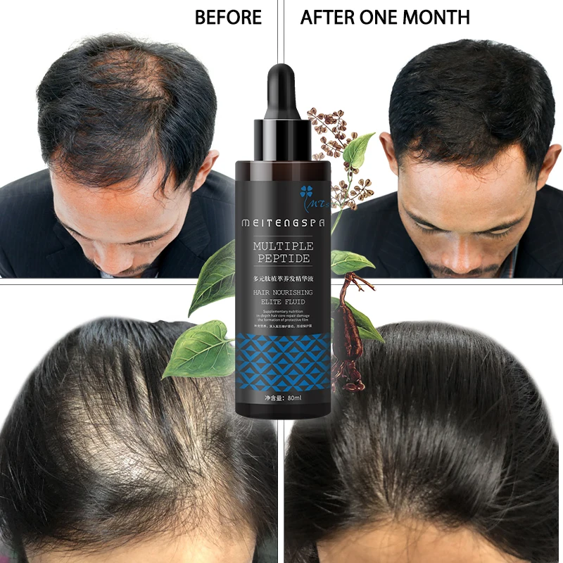
hair regrowth essence grow hair serum OEM/ODM private label anti hair loss oil 