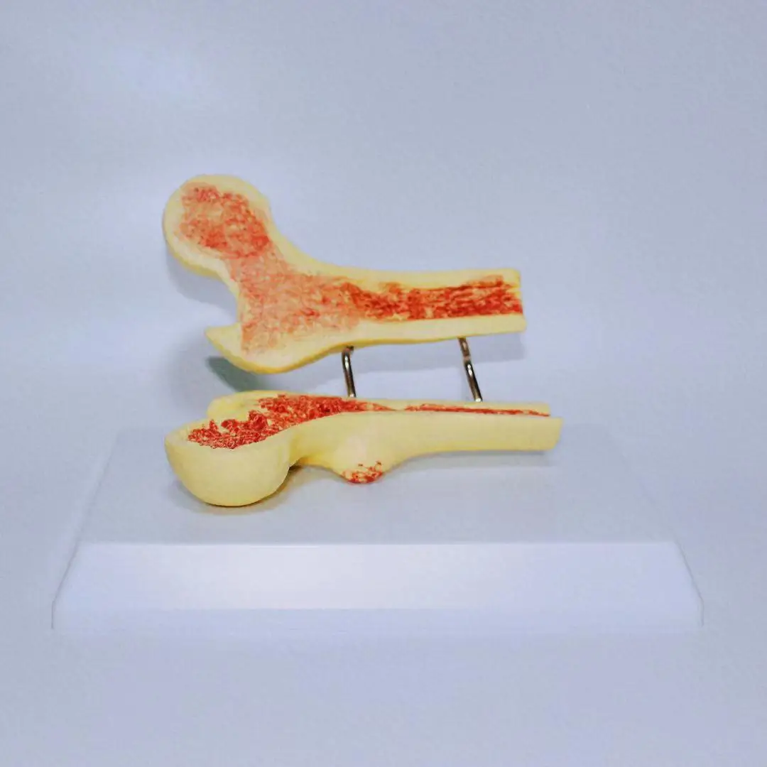 2021 new listing made of durable materials dedicated to teaching osteoporosis skeleton model