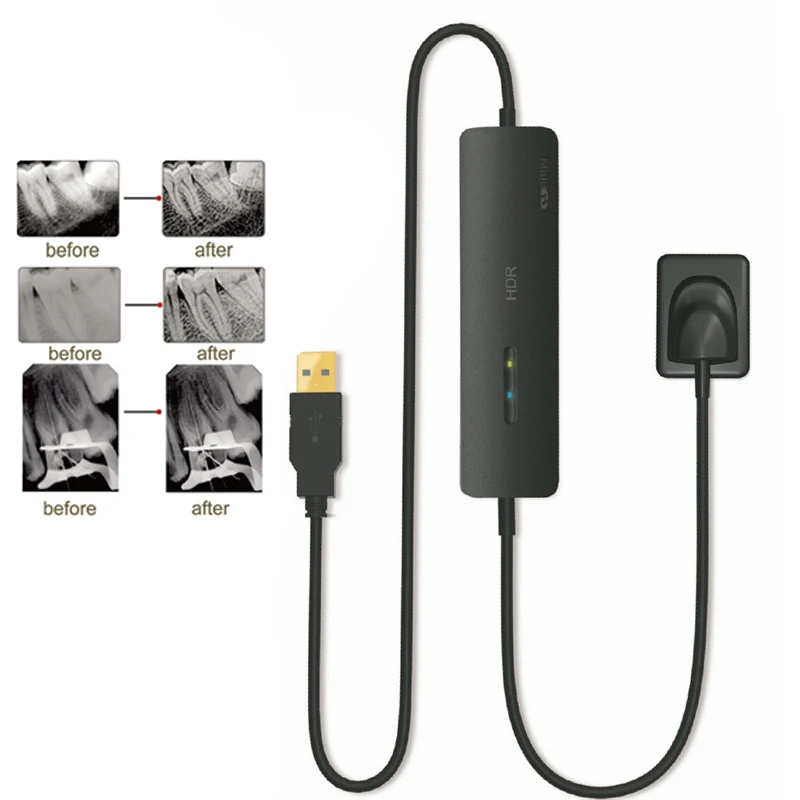 New Digital Dental X Ray Sensor HDR500 HDR600 RVG Sensor High Definition Imaging System Intraoral Sensor
