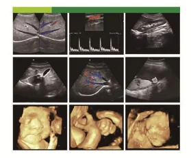 Мобильный телефон ультразвуковой сканер Vet цена D Ультразвуковой новинка
