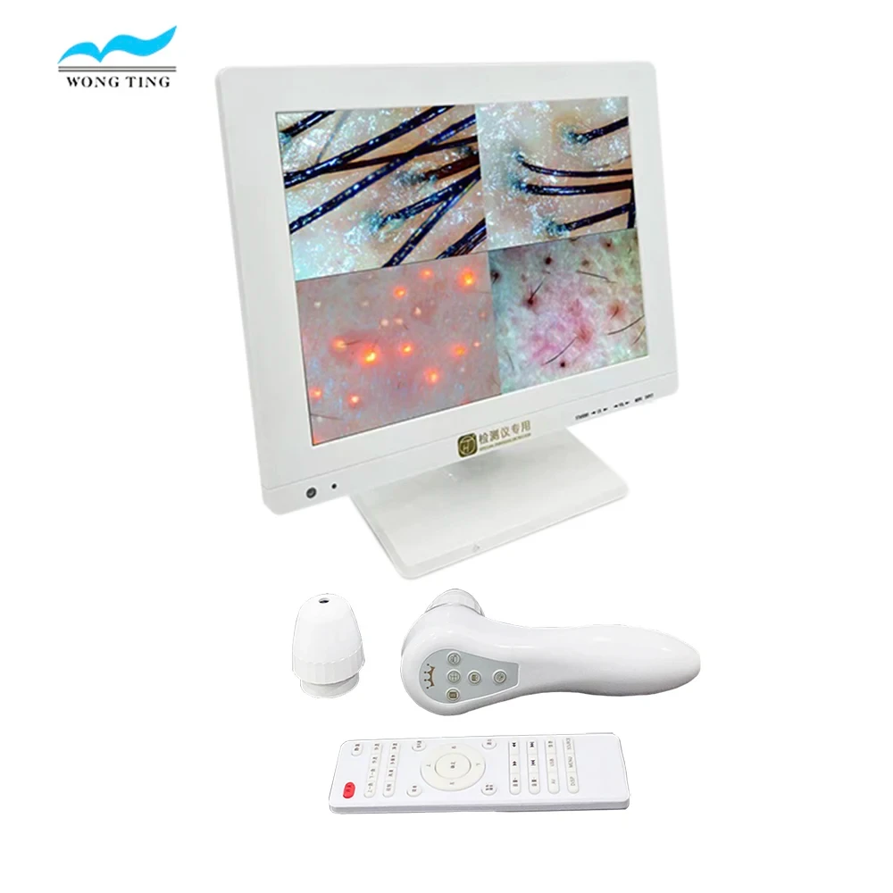 Hair follicles scalp scanner hair analysis functional equipment beauty equipment wholesalers