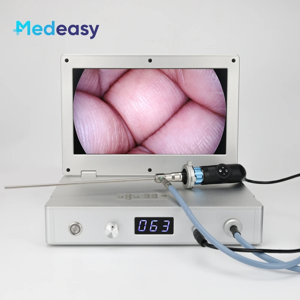 Full HD 1080P 15.6 Inch Laptop Integrated Endoscopic Camera System with 80W LED Light Source and Video Recorder