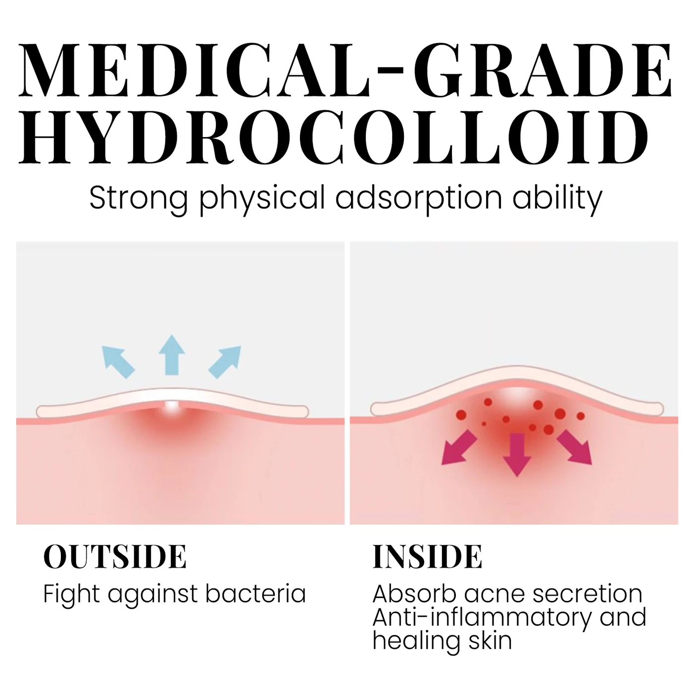 OEM ODM Manufacturer Private Label Hydrocolloid Acne Pimple Patch