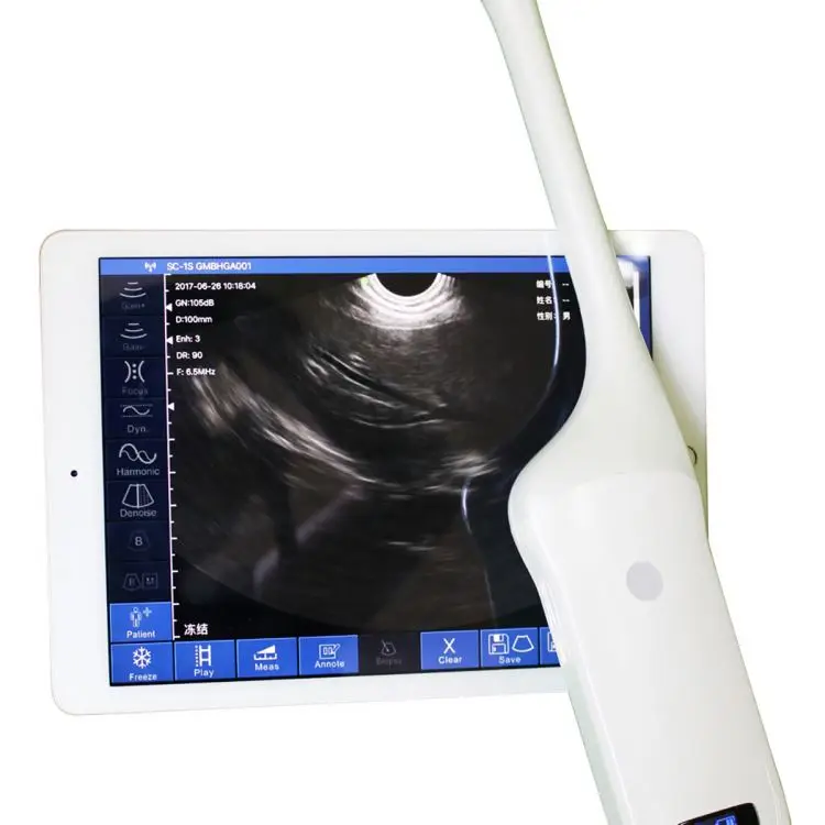 
Wireless Transvaginal Probe For Gynecological Follicle Testing, Uterine Examination And Visualization Guidance 