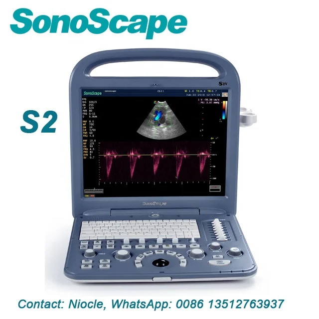 Портативный Цветной Допплер sonoscape ultrasonido Sonoscape S2 3d