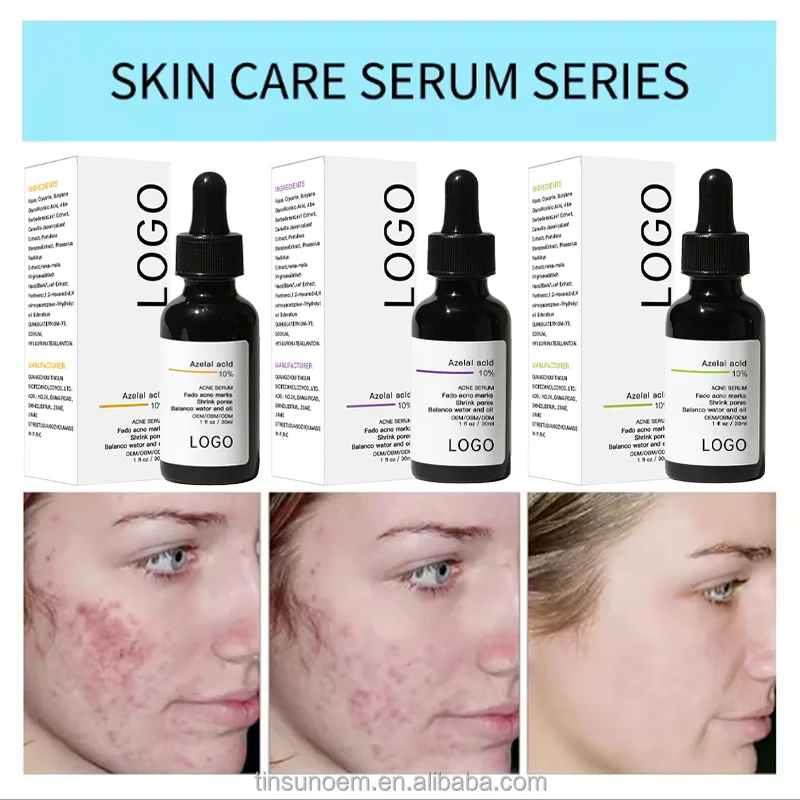 OEM/DOMacne treatment Black Head Remover Beauty Face Skin Care Anti Acne Removal Azelaic Acid Serum Products