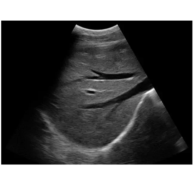 4D Full Digital Color Doppler Ultrasound Diagnostic System Competitive Price 6 Languages Portable Ultrasound