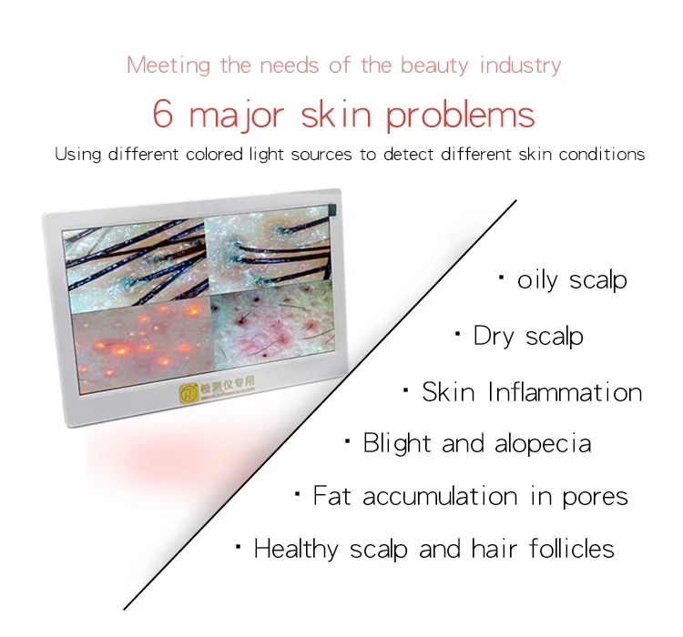 Hair follicles scalp scanner hair analysis functional equipment beauty equipment wholesalers