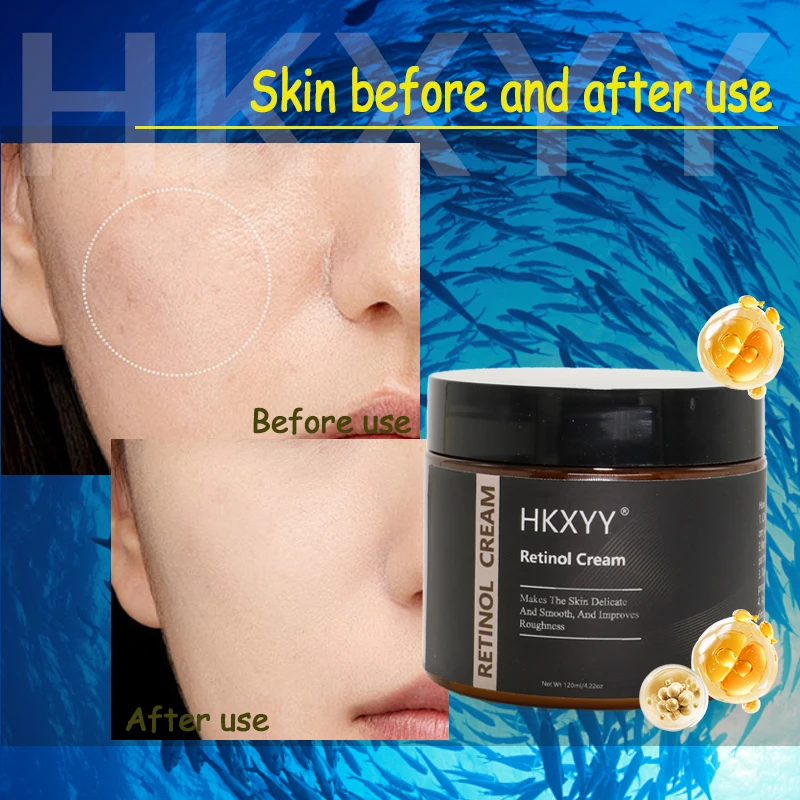 Anti Aging Hydrating Hyaluronic Serum Acid Resurfacing Retinol Serum Skin Renewing Retinol Serum
