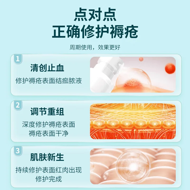 Haemostatic Functional Medical Decubitus Cream Diabetic External Wound Decubitus Special Spray