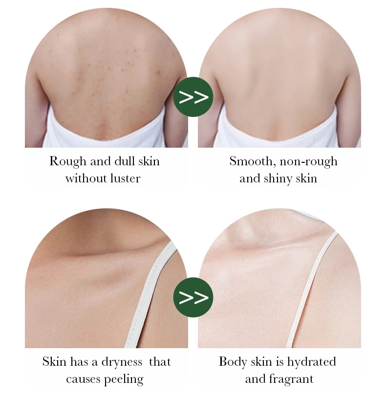 Customize Cosmetics Hyaluronic Acid Blenching Nourishing Coconut Body Gel