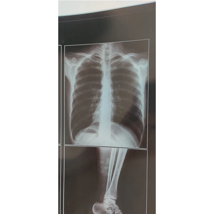 
medical dry imaging film DI-HT 