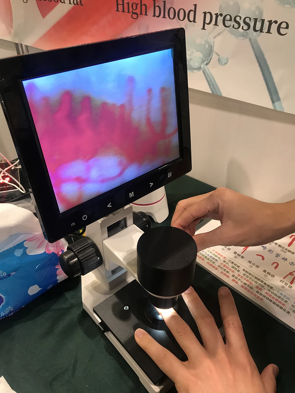 Гироборд с колесами 8 дюймов ЖК-цифровой микроскоп микроциркуляции биологический USB для банка крови дисплей nailfold капиллярные