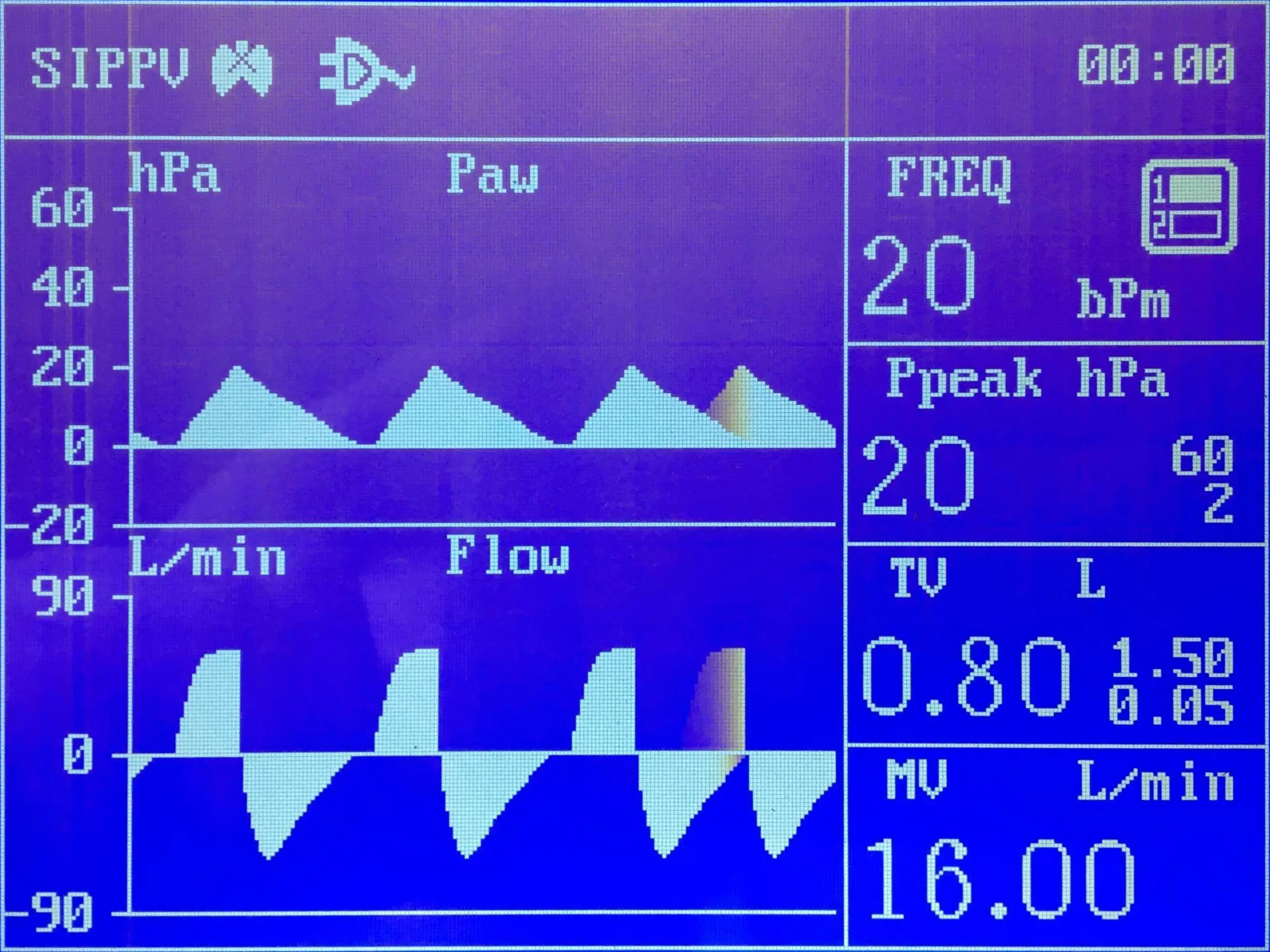 Top quality Anesthesia machine manufacturer JINLING-01B with ISO