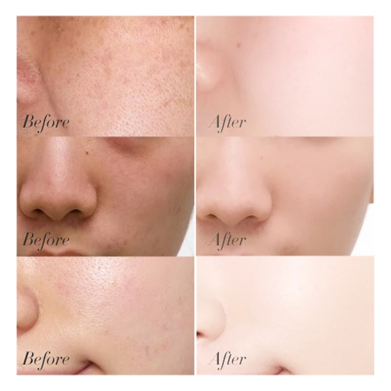 private label whitening vitamin c face serum skin care Brightening Anti Aging wrinkle Vitamin E Organic Aloe Vera facial serum