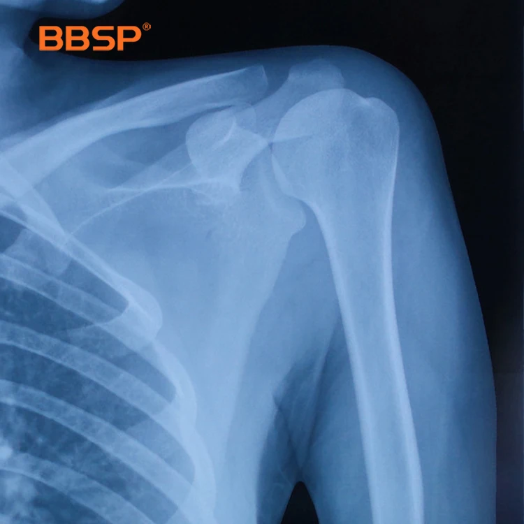 Full size blue dry film Medical X-ray Blue Sensitive X-ray Image X Ray Film