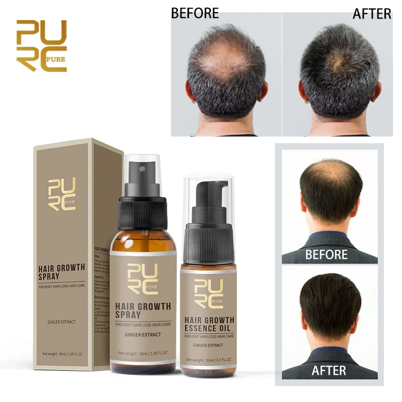 
Private label anti hair loss fast hair growth shampoo 