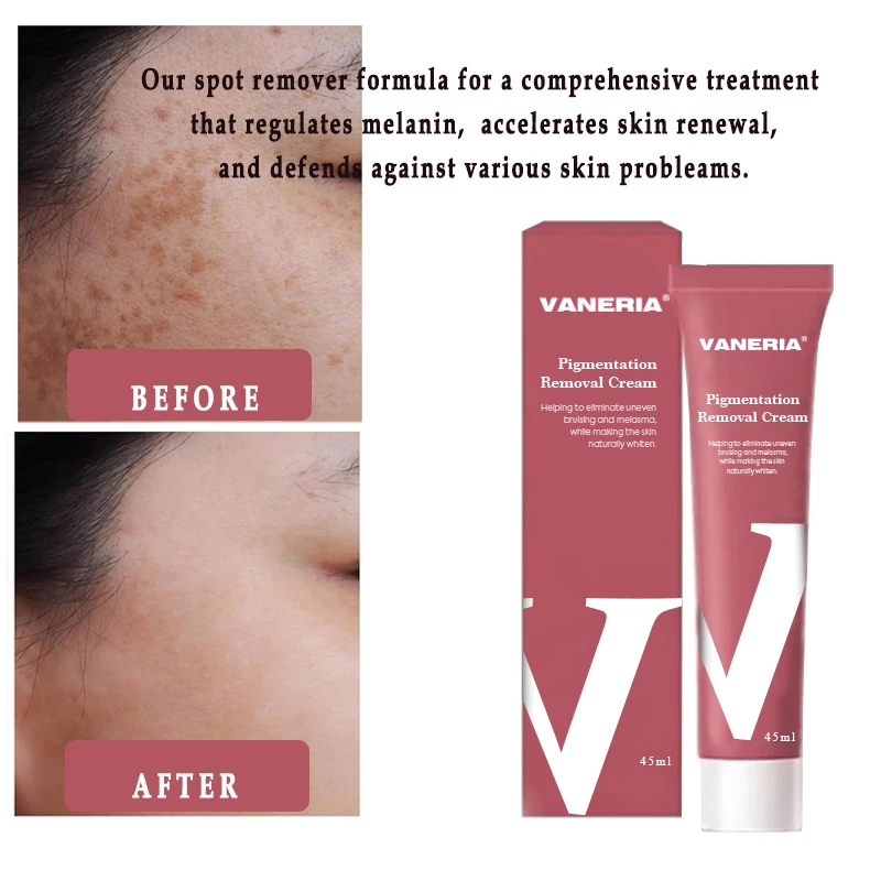 Whitening Cream Skin Care Products Brightening Nourishing Whitening Organic Corrector Remover Face Pigmentation Removal Cream