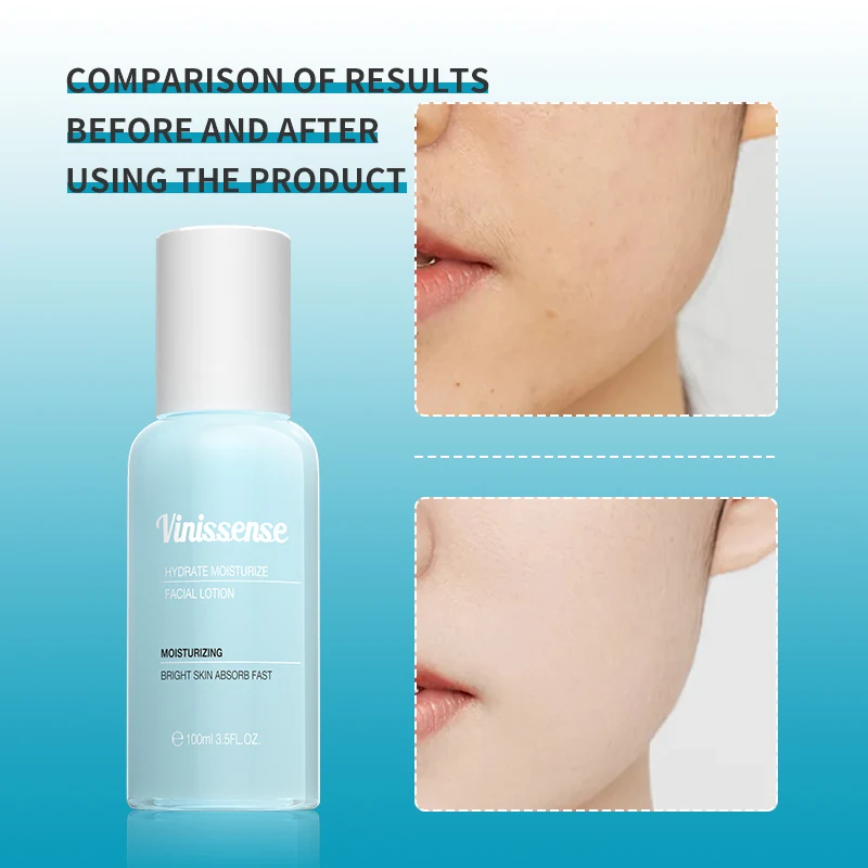 Vinissense Hydrating Moisturizing Facial Lotion 100ml Hydrates dry skin, soothes replenishes skin OEM ODM customized