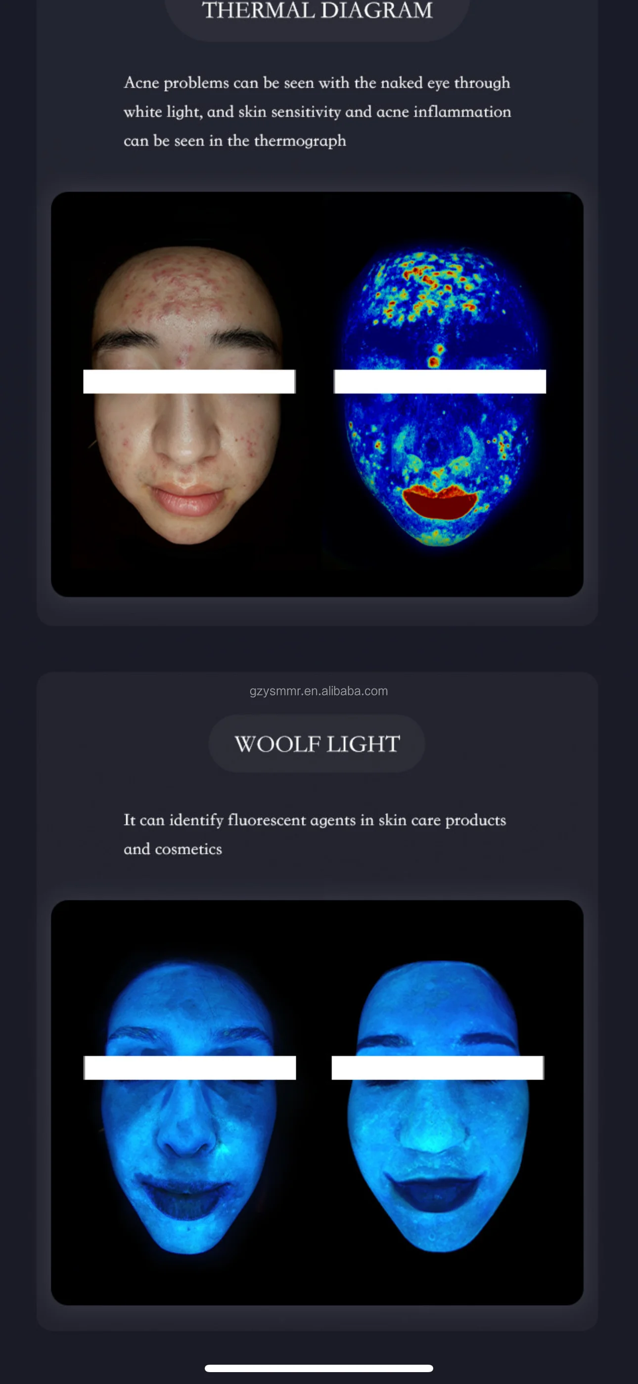 Advanced professional face analysis instrument  skin analyzer profession
