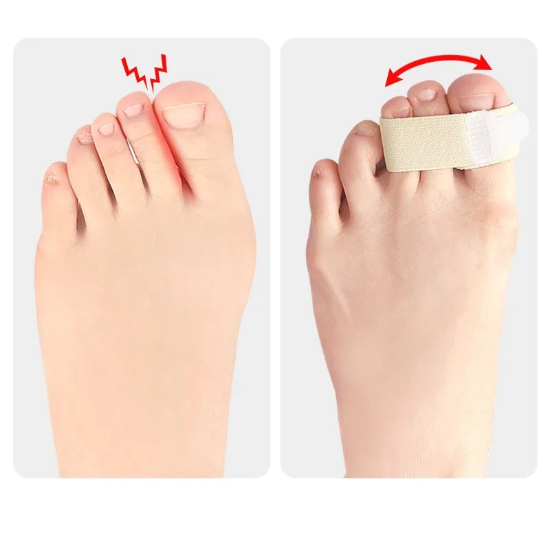 Elastic toe with finger splitter