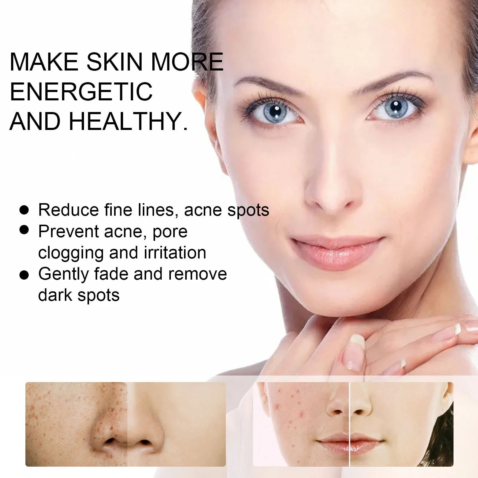20g Effective Whitening Freckle Cream Remove Acne Dark Spot Fade Pigmentation Melasma Brighten Anti Freckle Cream