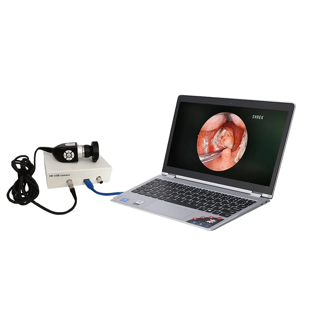 medical usb endoscope system hd 1080p ent camera