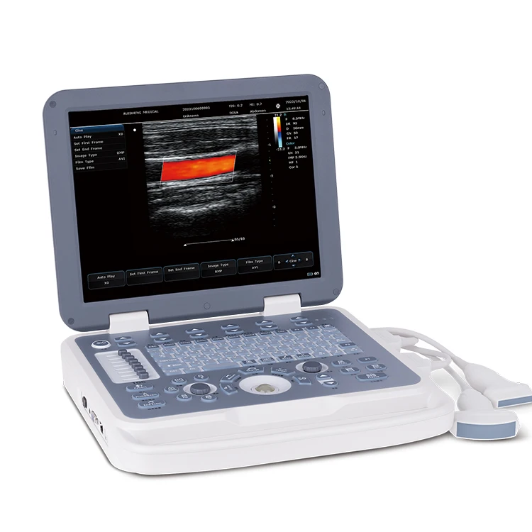Color Doppler Ultrasonic Diagnostic System Large Screen Echocardiography Machine Portable Instruments for Vet or Human
